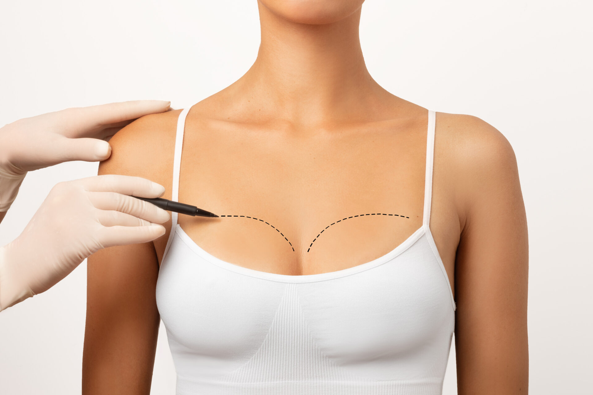 Plastic surgeon marking woman's breast, drawing lines on chest, white studio background, closeup, cropped Plastic surgeon marking woman's breast, drawing lines on chest, white studio background, closeup, cropped